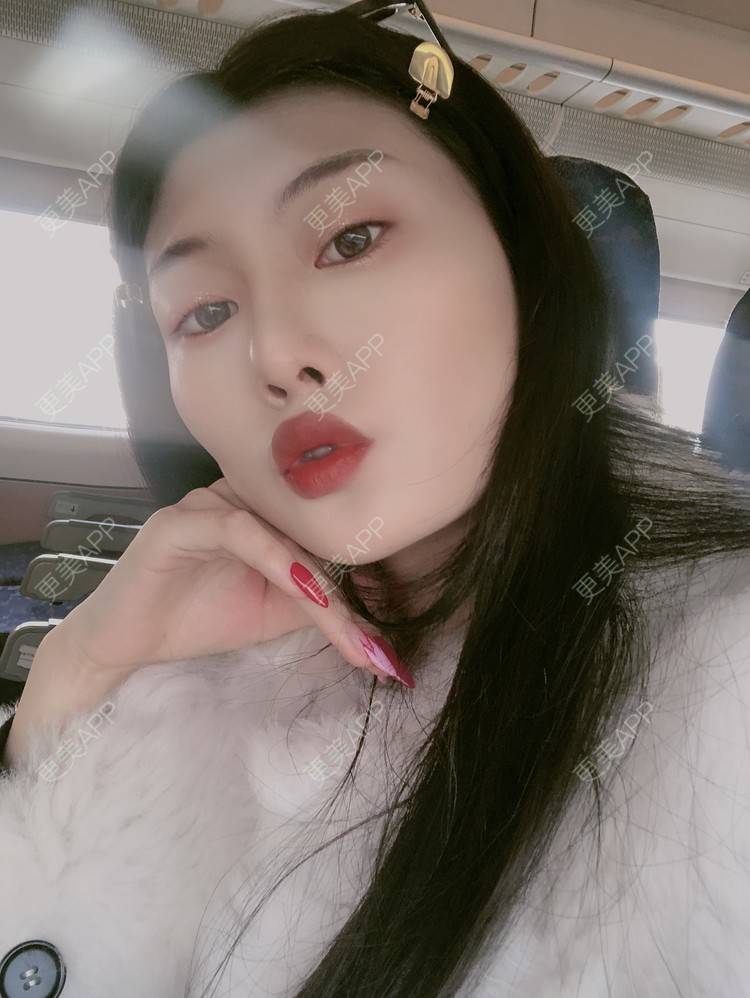 更美 - 更美用户d9XraeiAfE的鼻部多项经验 | 鼻部多项 | 清远