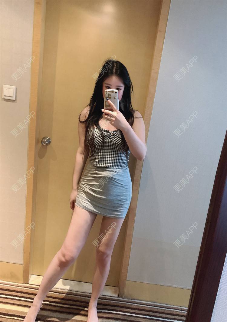 更美 - 碰撞的艺术1的腰腹吸脂经验 | 腰腹吸脂 | 背部吸脂 | 吸脂瘦大腿 | 重庆