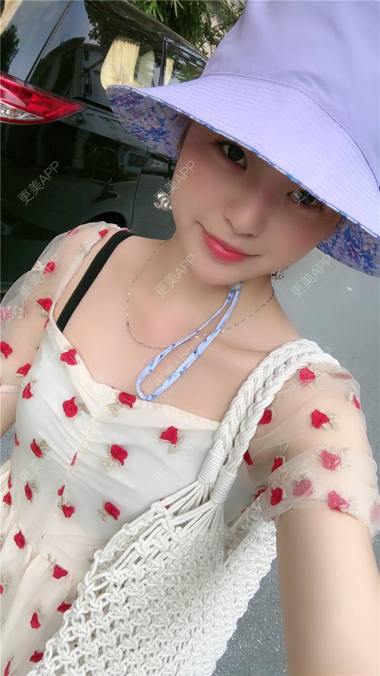更美 - 原来就是你们的耳软骨隆鼻经验 | 耳软骨隆鼻 | 广州 | 视频日记