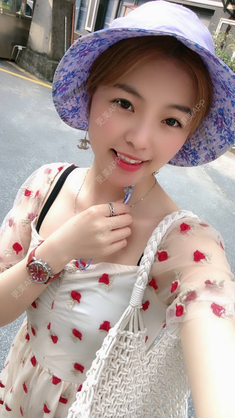 更美 - 原来就是你们的耳软骨隆鼻经验 | 耳软骨隆鼻 | 广州 | 视频日记
