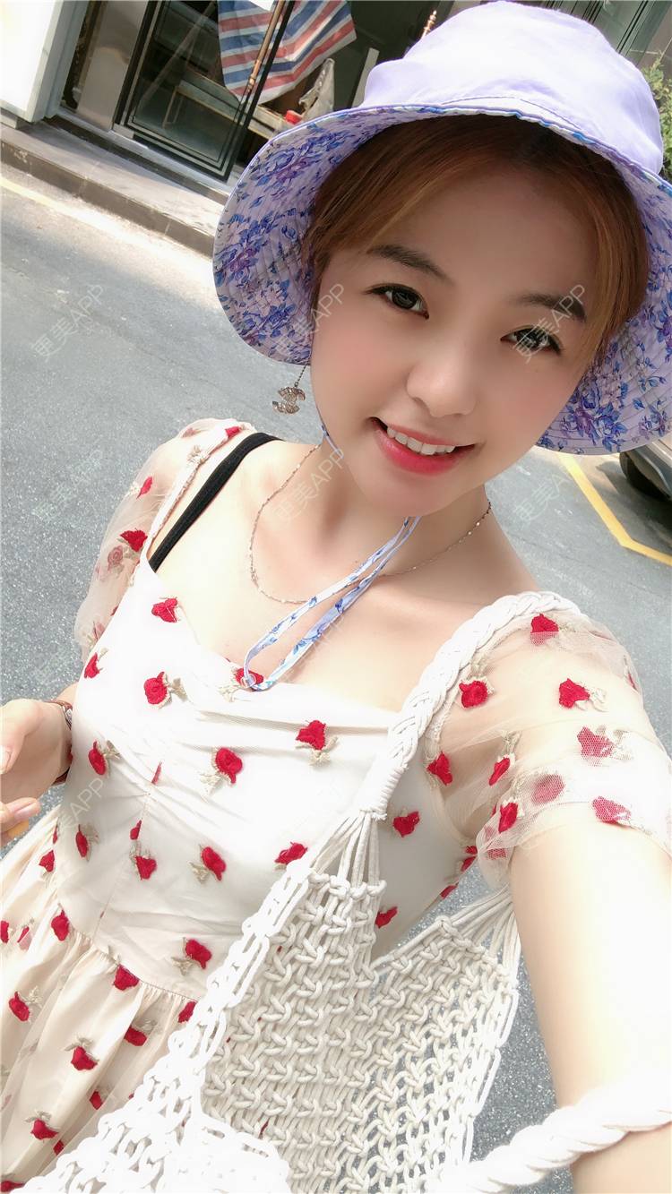 更美 - 原来就是你们的耳软骨隆鼻经验 | 耳软骨隆鼻 | 广州 | 视频日记