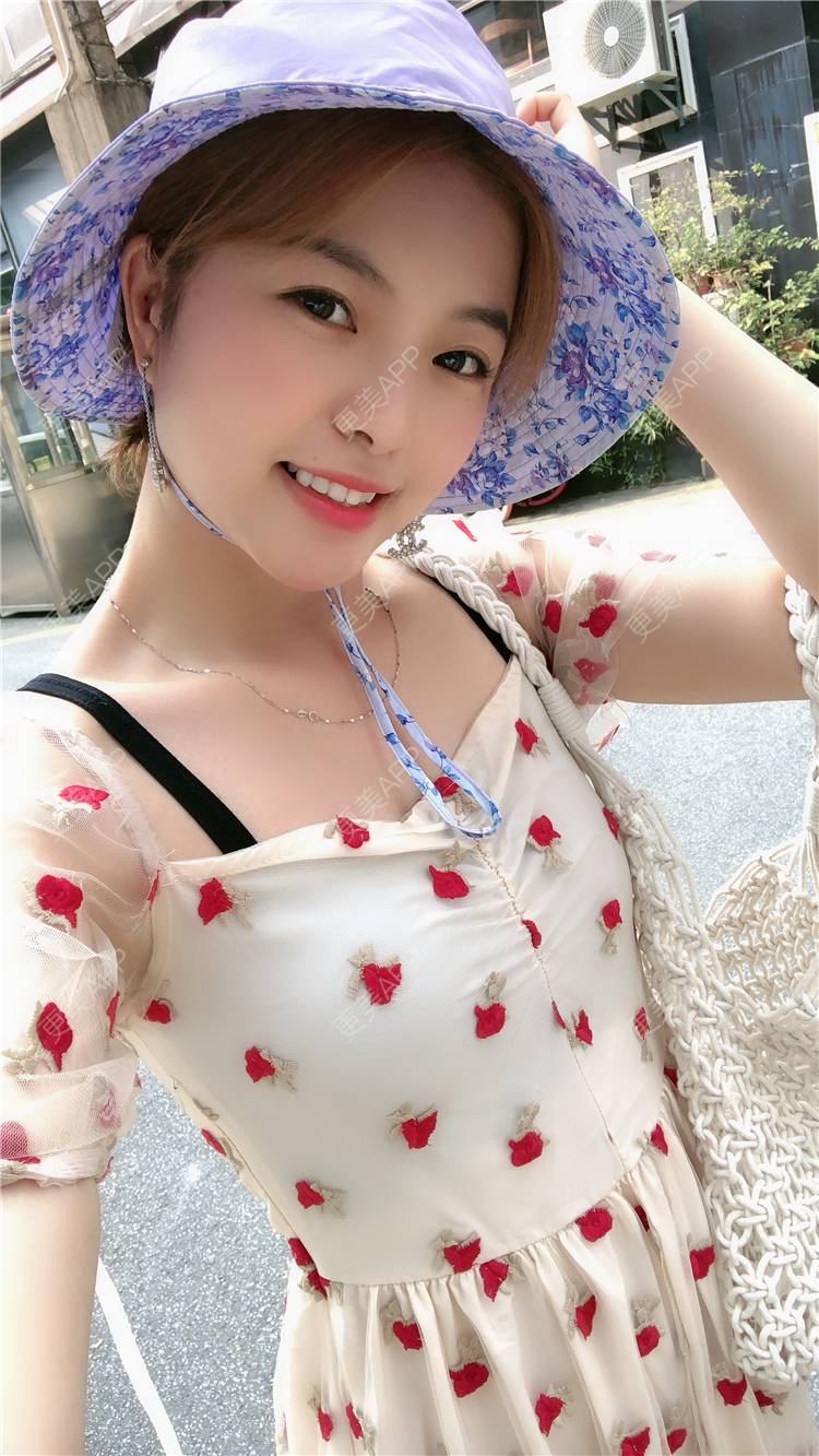 更美 - 原来就是你们的耳软骨隆鼻经验 | 耳软骨隆鼻 | 广州 | 视频日记