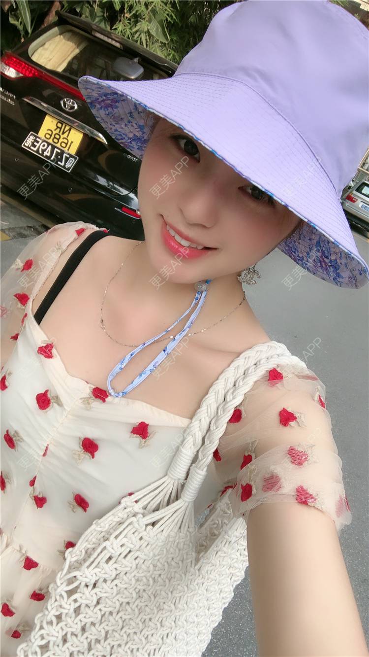 更美 - 原来就是你们的耳软骨隆鼻经验 | 耳软骨隆鼻 | 广州 | 视频日记