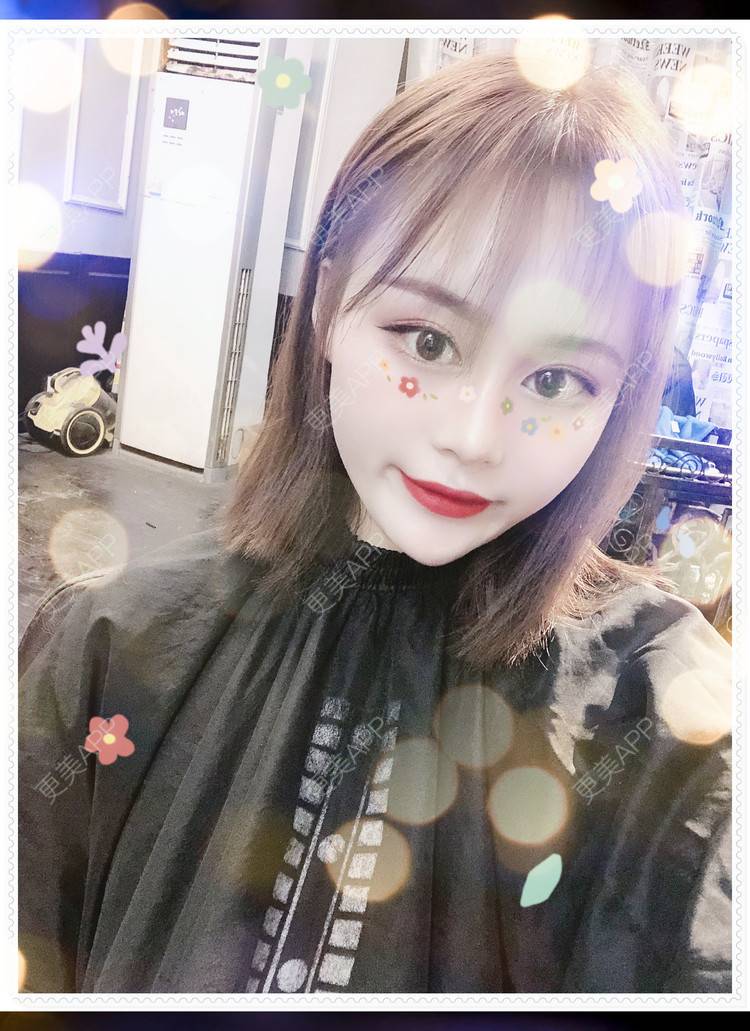 更美 - 更美用户8mS8cMiXpR的双眼皮经验 | 双眼皮 | 无锡