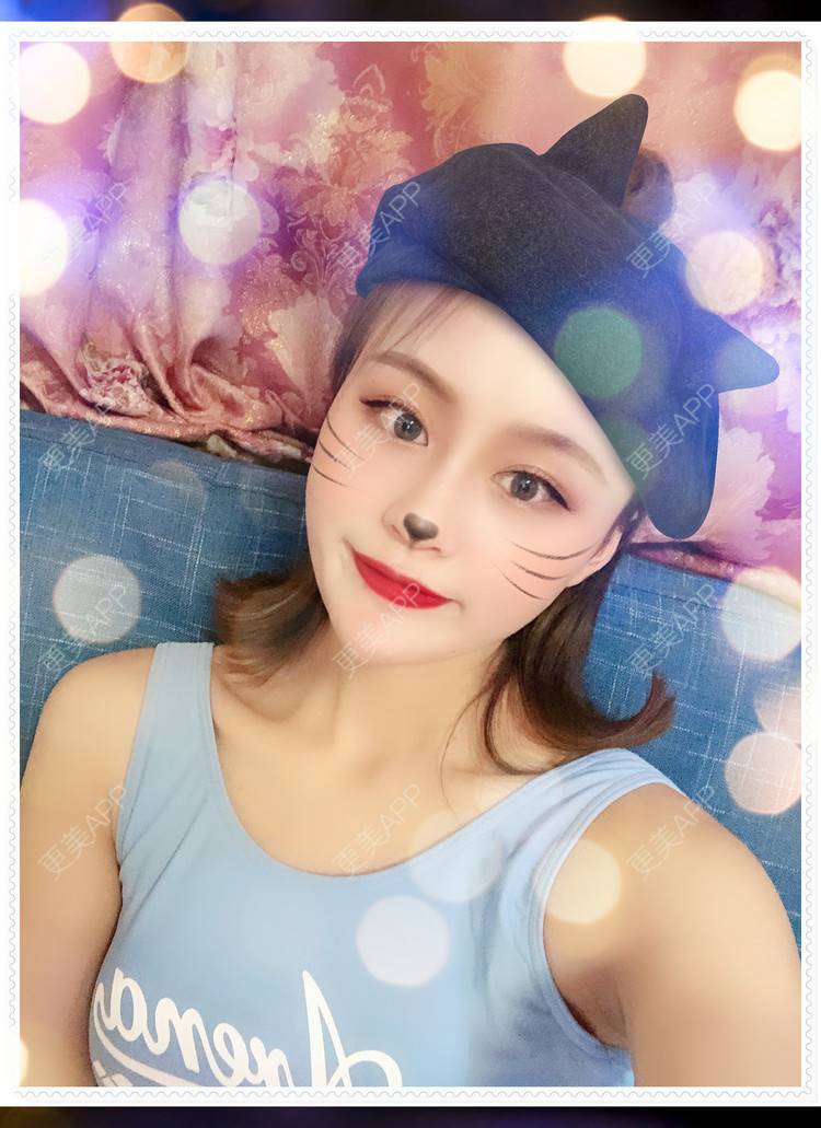 更美 - 更美用户8mS8cMiXpR的双眼皮经验 | 双眼皮 | 无锡