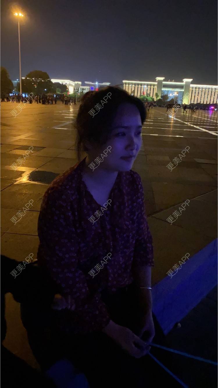 更美 - 奥多Ke。的植发际线经验 | 植发际线 | 南昌