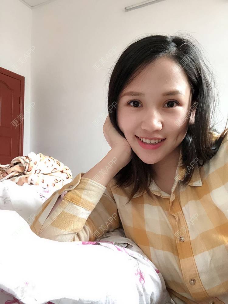 更美 - 更美用户R6xSXj7DGy的埋线提升经验 | 埋线提升 | 广州