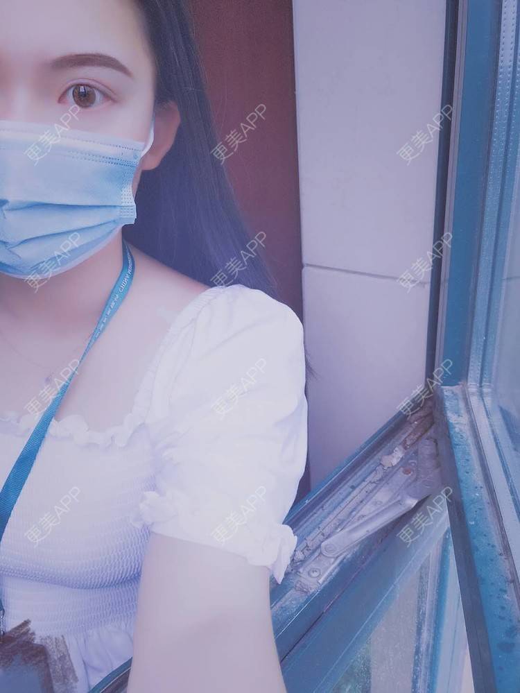 更美 - 璀璨太阳花骨朵的双眼皮修复经验 | 双眼皮修复 | 全切双眼皮 | 合肥 | 上眼睑去脂 | 开眼角修复
