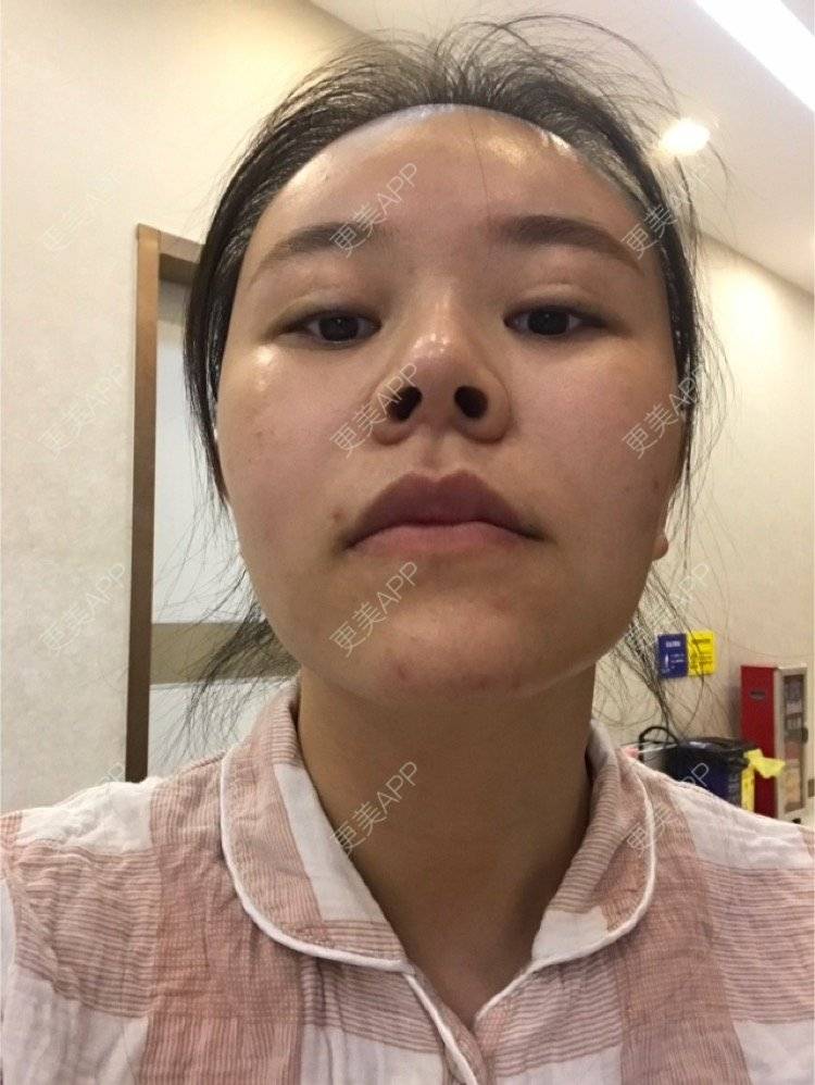 更美 - 更美用户iuB00h31N3的鼻部多项经验 | 鼻部多项 | 广州