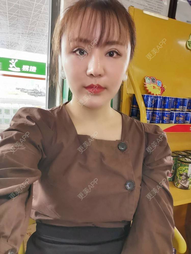 更美 - 静静子子的鼻部多项经验 | 鼻部多项 | 首尔