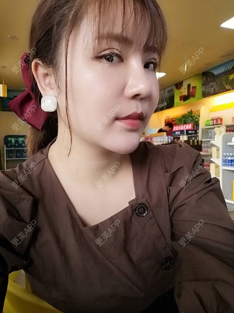 更美 - 静静子子的鼻部多项经验 | 鼻部多项 | 首尔