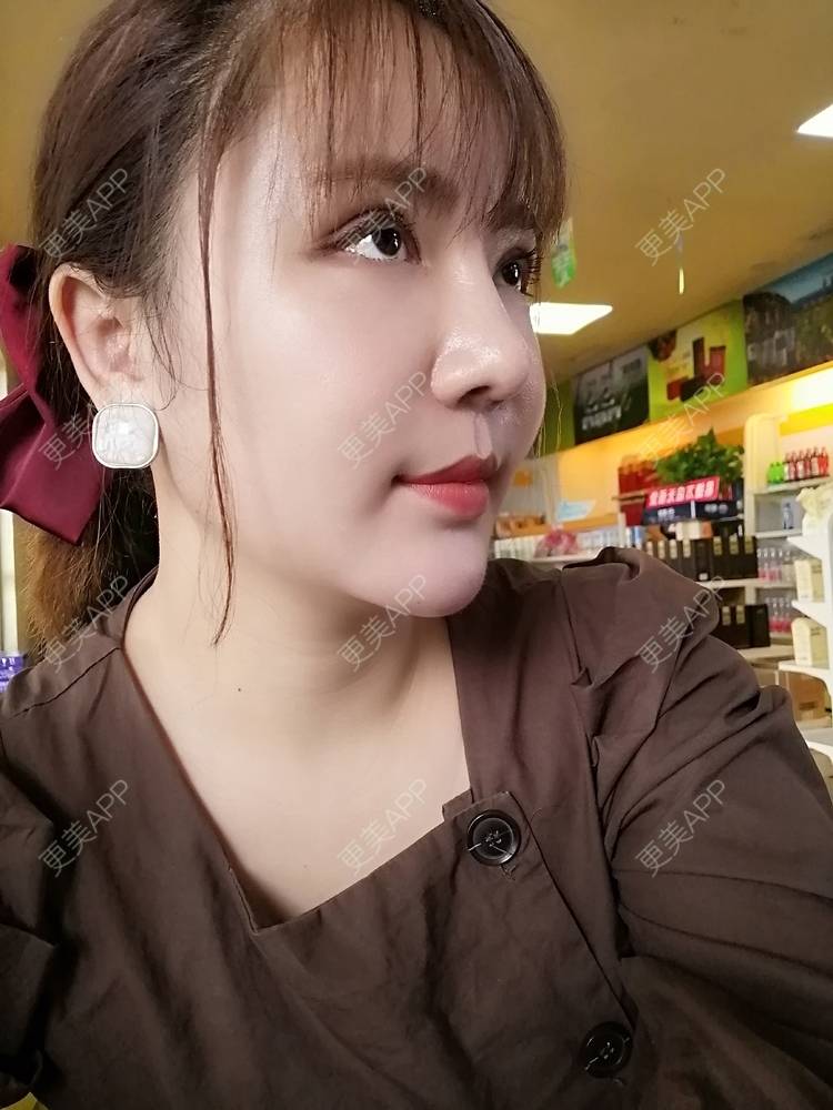 更美 - 静静子子的鼻部多项经验 | 鼻部多项 | 首尔