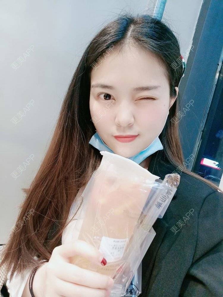 更美 - 更美用户uK1ce6rfue的全切双眼皮经验 | 广州 | 眼部综合