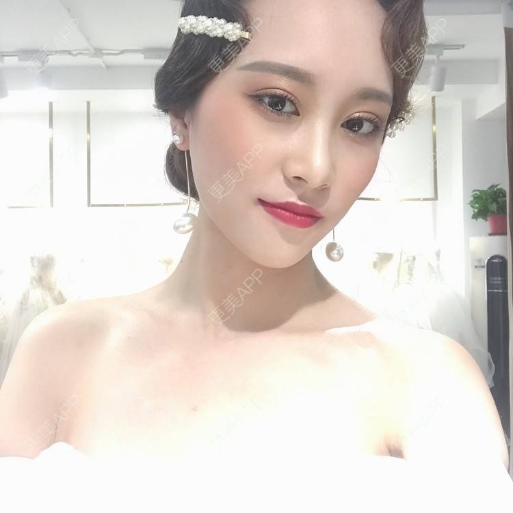 更美 - 半夏0的双眼皮经验 | 双眼皮 | 成都 | 大腿脱毛 | 更美研究所 | 视频日记