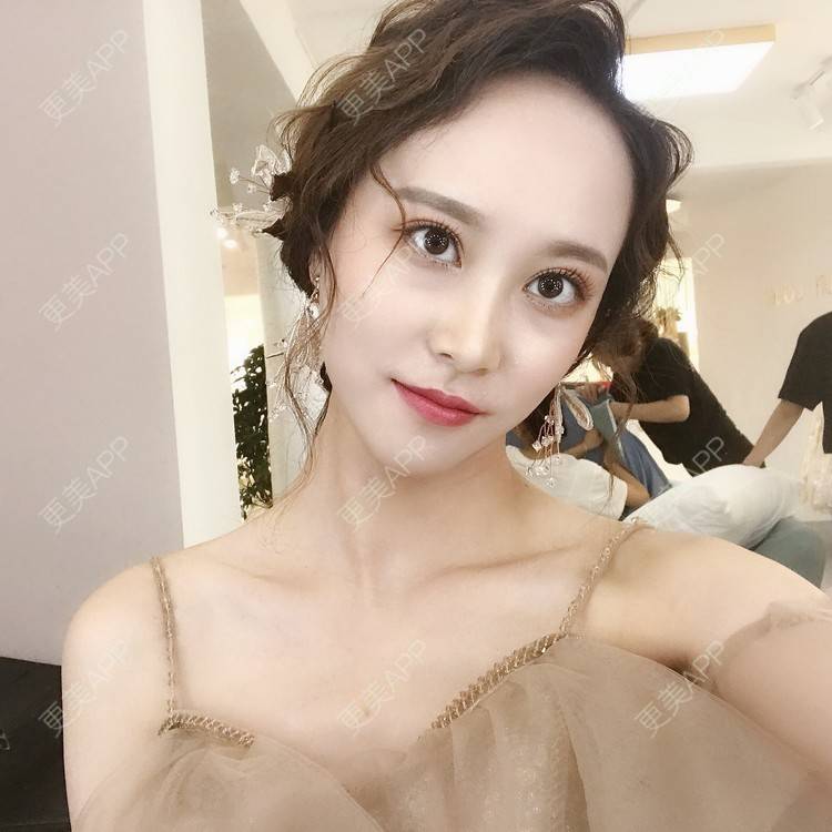 更美 - 半夏0的双眼皮经验 | 双眼皮 | 成都 | 大腿脱毛 | 更美研究所 | 视频日记