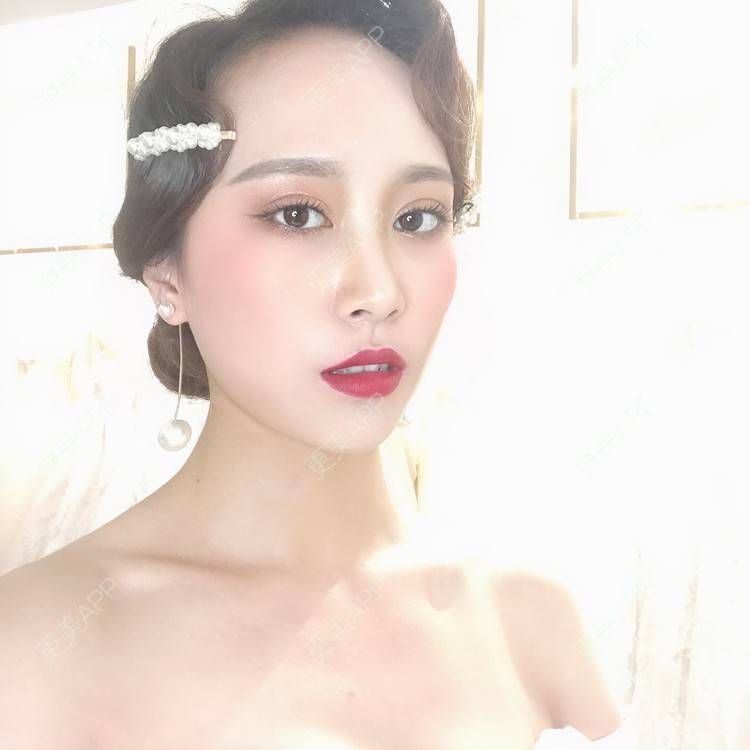 更美 - 半夏0的双眼皮经验 | 双眼皮 | 成都 | 大腿脱毛 | 更美研究所 | 视频日记