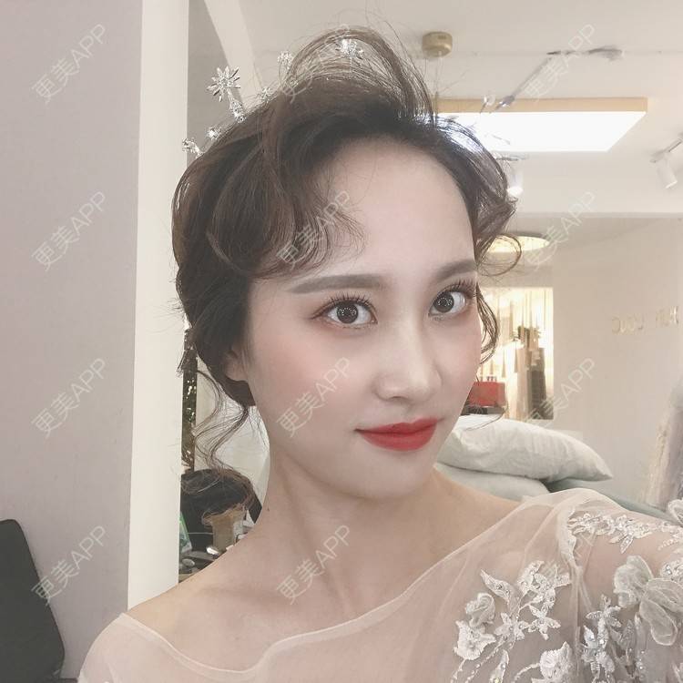 更美 - 半夏0的双眼皮经验 | 双眼皮 | 成都 | 大腿脱毛 | 更美研究所 | 视频日记
