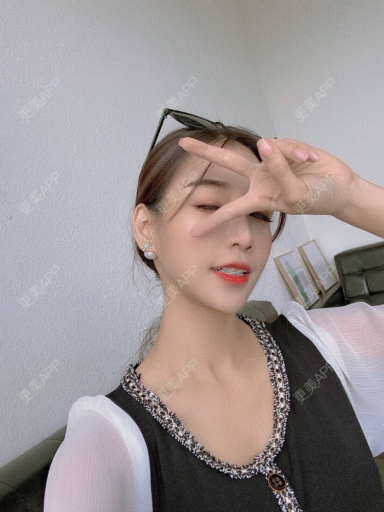 更美 - －Ｊane.’的牙齿矫正经验 | 牙齿矫正 | 广州
