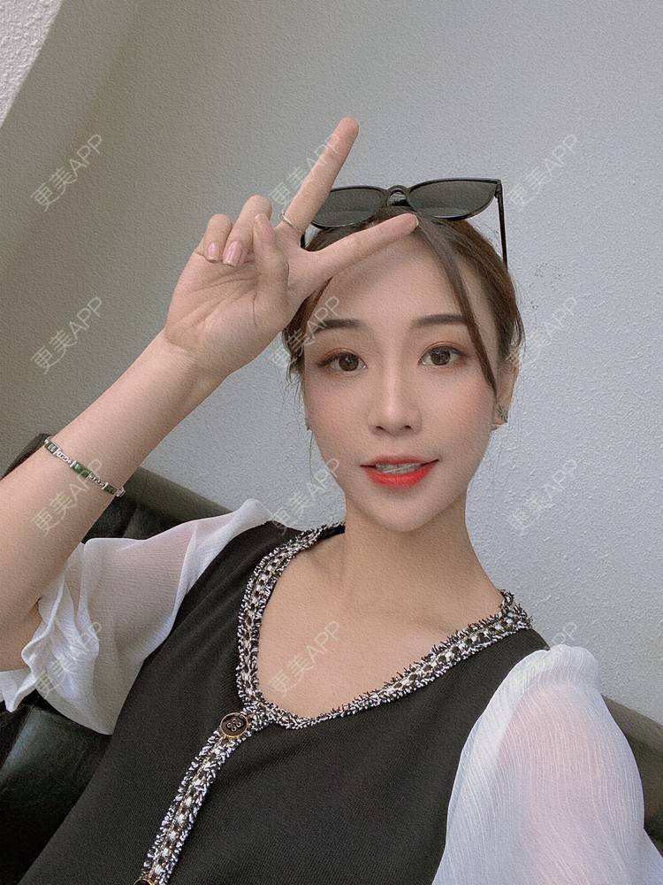 更美 - －Ｊane.’的牙齿矫正经验 | 牙齿矫正 | 广州