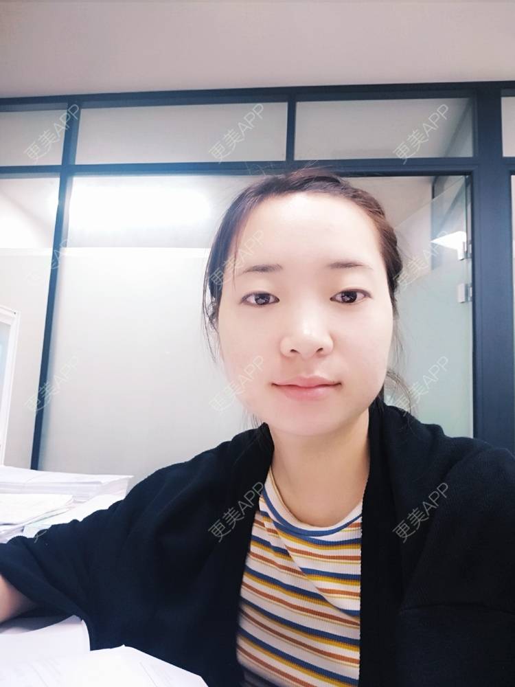更美 - 橙子Jiang的牙齿矫正经验 | 牙齿矫正 | 成都
