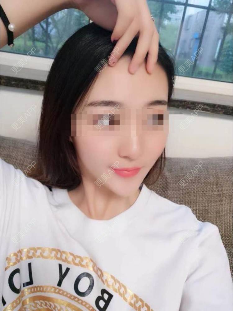 更美 - 更美用户8nX7eyJdyA的除皱经验 | 除皱 | 长沙