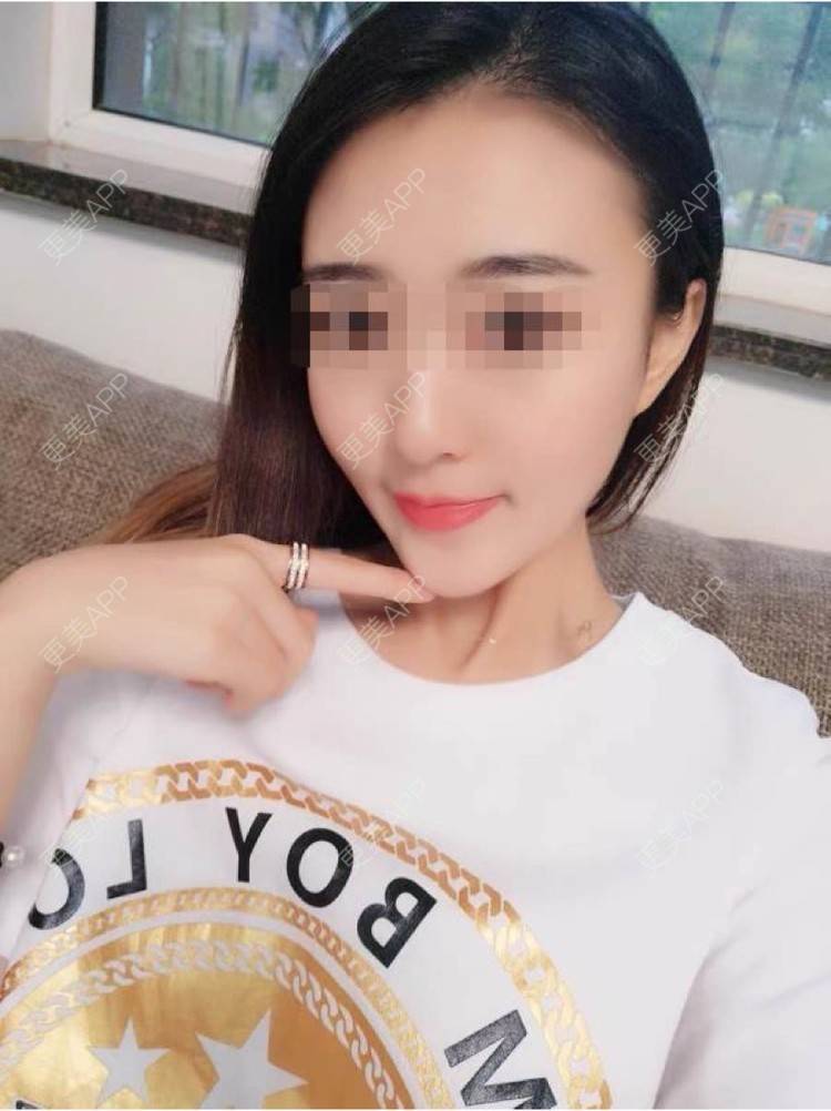 更美 - 更美用户8nX7eyJdyA的除皱经验 | 除皱 | 长沙