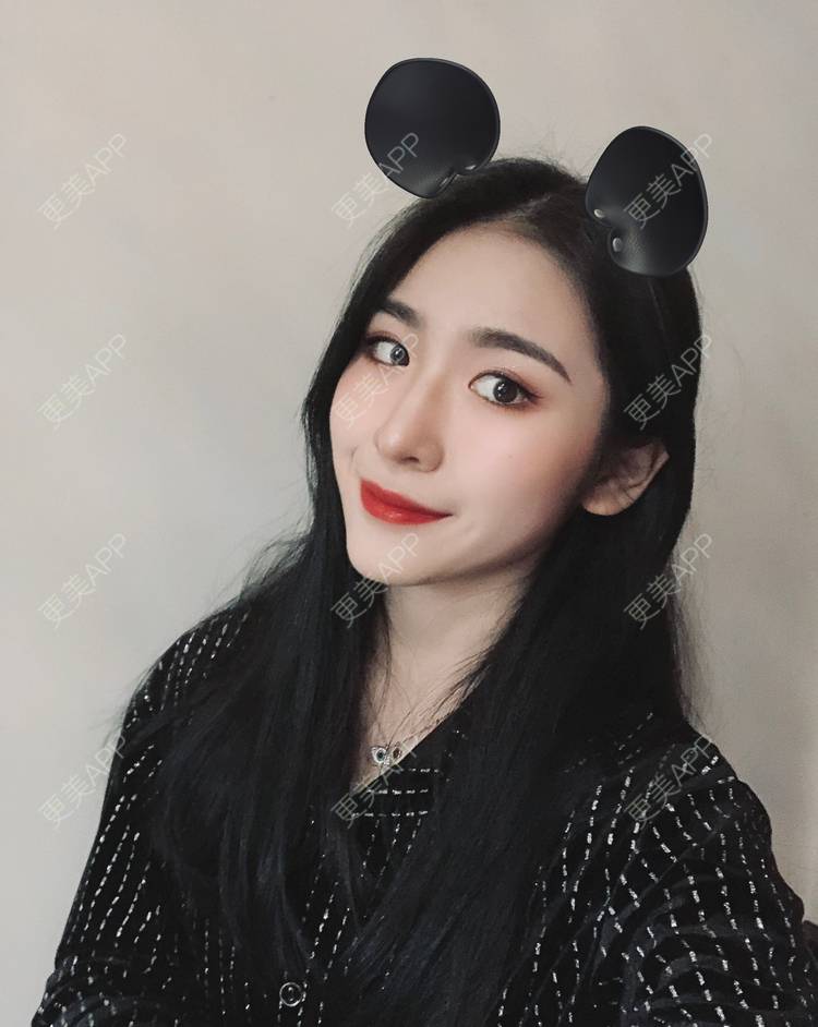 更美 - 耳朵里有心事儿的热玛吉经验 | 彩光嫩肤 | 北京 | 镭射净肤