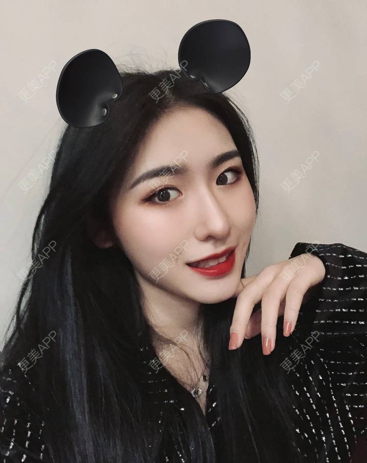 更美 - 耳朵里有心事儿的热玛吉经验 | 彩光嫩肤 | 北京 | 镭射净肤