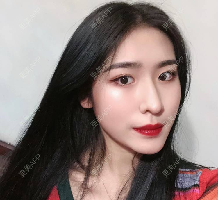 更美 - 耳朵里有心事儿的热玛吉经验 | 彩光嫩肤 | 北京 | 镭射净肤