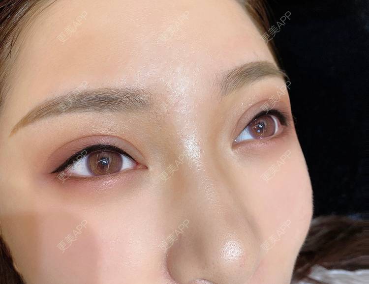更美 - 奥力给吗的半永久纹眼线经验 | 半永久纹眼线 | 广州