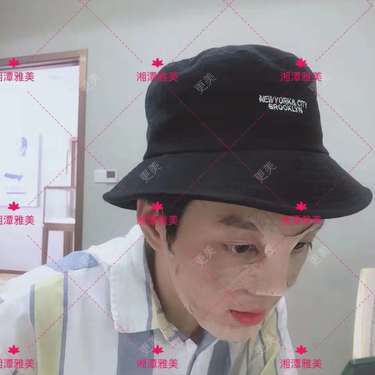 刘斌 医生