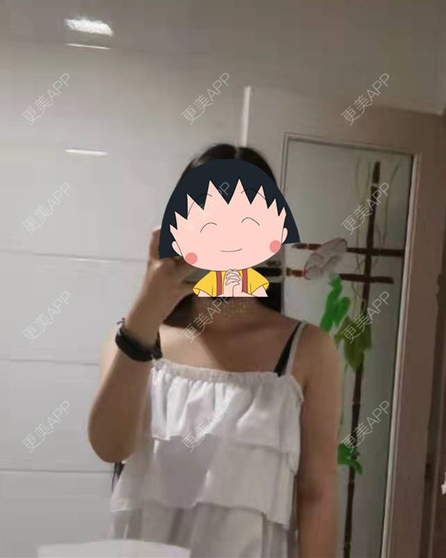 更美 - 更美用户jHjijlJNxV的手臂吸脂经验 | 手臂吸脂 | 广州