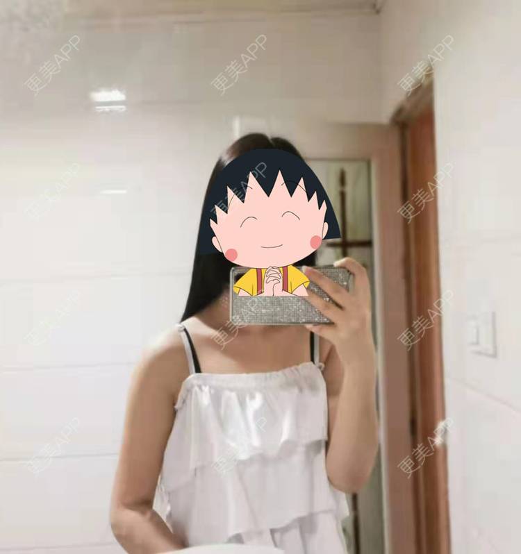 更美 - 更美用户jHjijlJNxV的手臂吸脂经验 | 手臂吸脂 | 广州