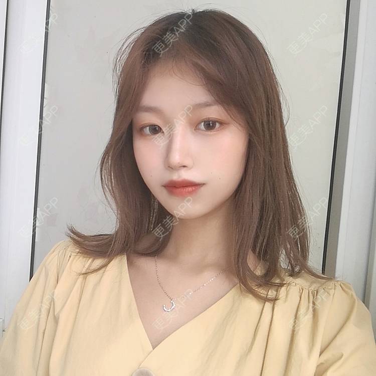 更美 - 不要奶茶的M唇成形经验 | M唇成形 | 杭州