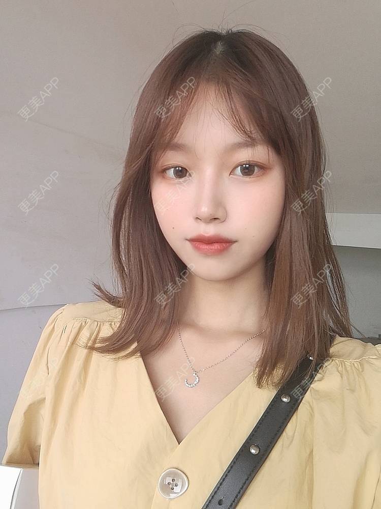 更美 - 不要奶茶的M唇成形经验 | M唇成形 | 杭州