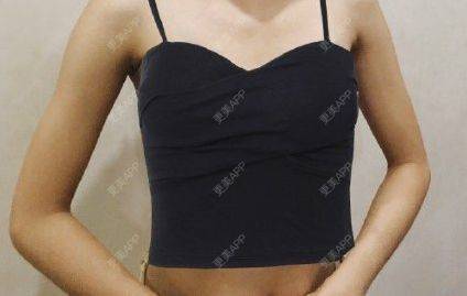 更美 - 执念吖的假体隆胸经验 | 假体隆胸 | 南昌