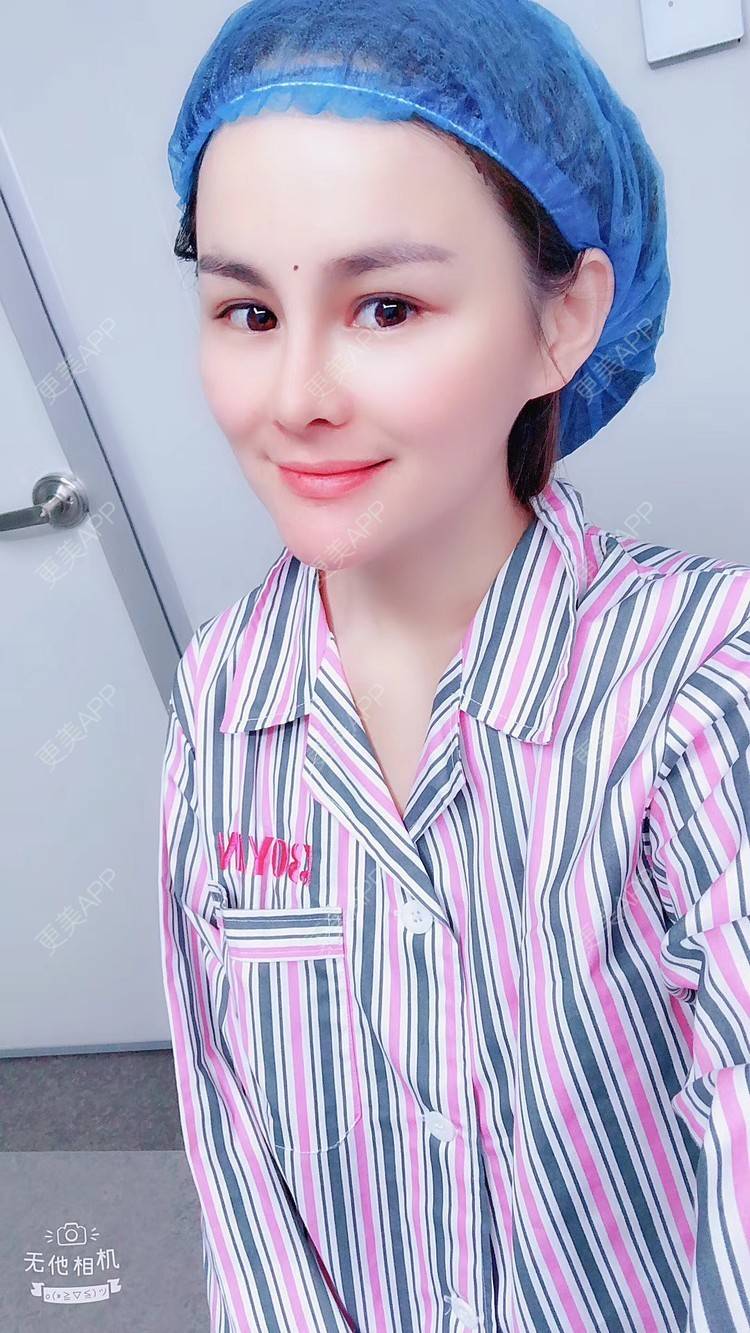 更美 - 博研马可的植发际线经验 | 植发际线 | 广州