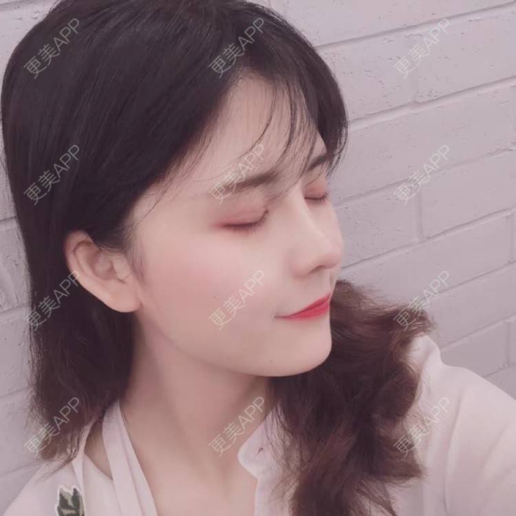 更美 - 爱的十字路口々苫的除皱经验 | 除皱 | 长沙