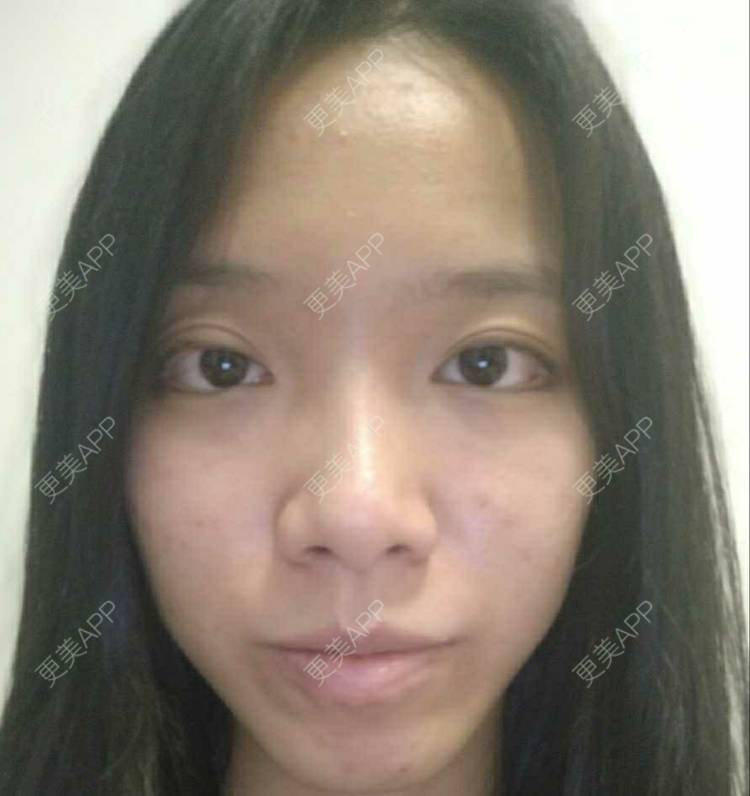 更美 - 更美用户Z60sk5dwpj的半永久纹眼线经验 | 广州 | 半永久纹眼线