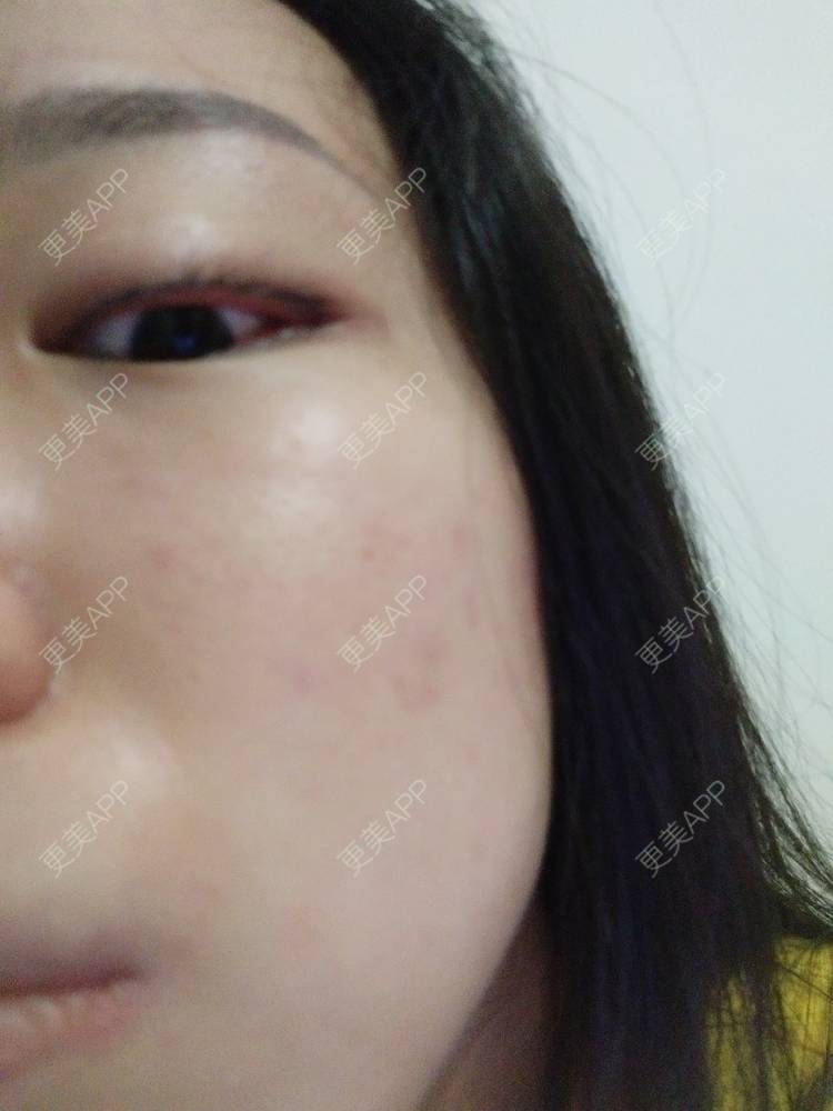 更美 - 更美用户Z60sk5dwpj的半永久纹眼线经验 | 广州 | 半永久纹眼线