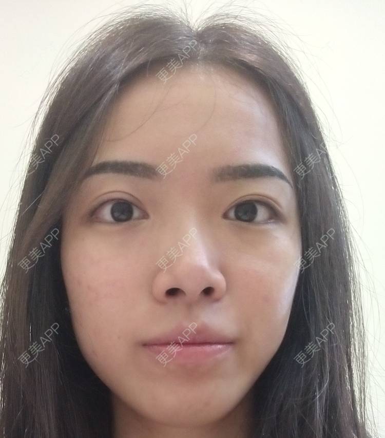 更美 - 更美用户Z60sk5dwpj的半永久纹眼线经验 | 广州 | 半永久纹眼线