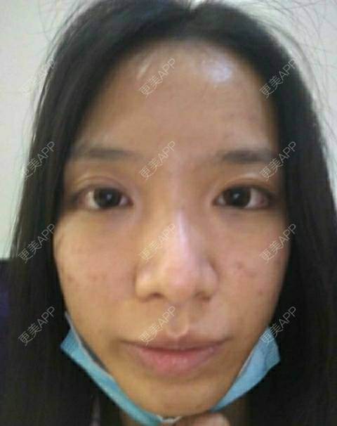 更美 - 更美用户Z60sk5dwpj的半永久纹眼线经验 | 广州 | 半永久纹眼线