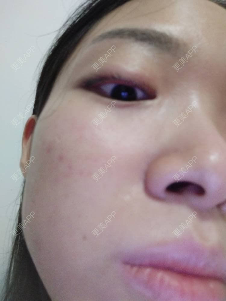更美 - 更美用户Z60sk5dwpj的半永久纹眼线经验 | 广州 | 半永久纹眼线