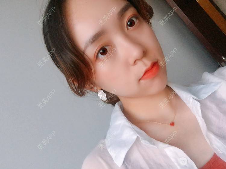 更美 - 更美用户m4XQ4UtYyh的菲欧曼经验 | 杭州 | 菲欧曼