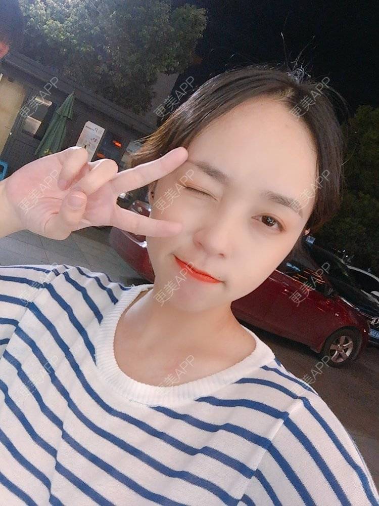 更美 - 更美用户m4XQ4UtYyh的菲欧曼经验 | 杭州 | 菲欧曼