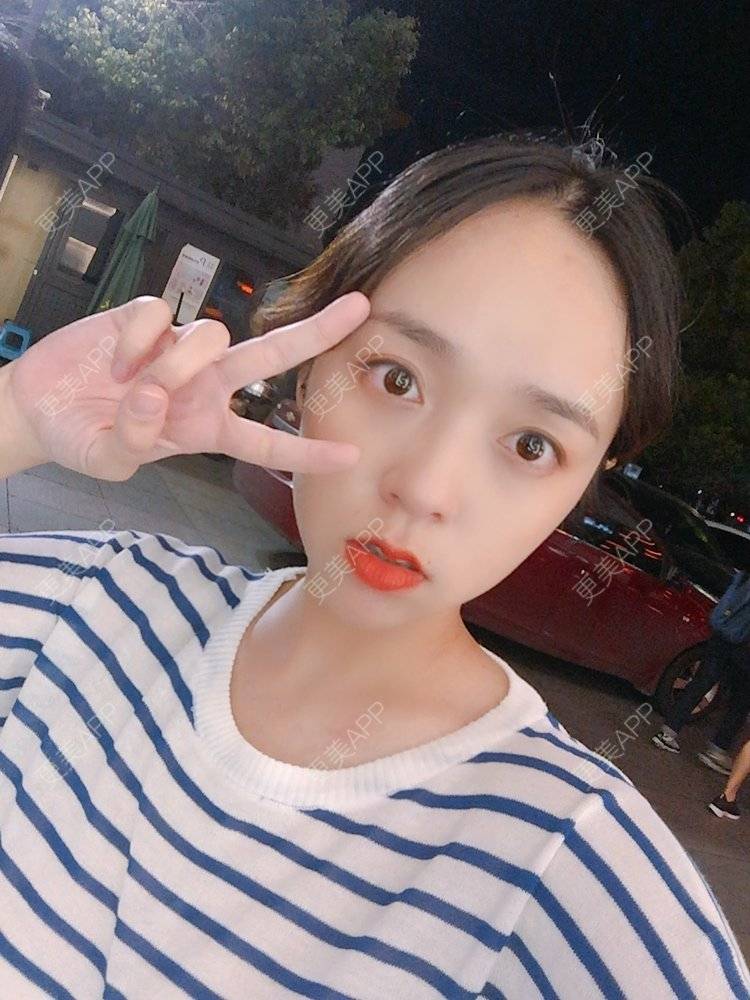 更美 - 更美用户m4XQ4UtYyh的菲欧曼经验 | 杭州 | 菲欧曼