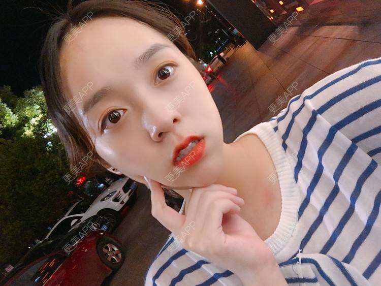 更美 - 更美用户m4XQ4UtYyh的菲欧曼经验 | 杭州 | 菲欧曼