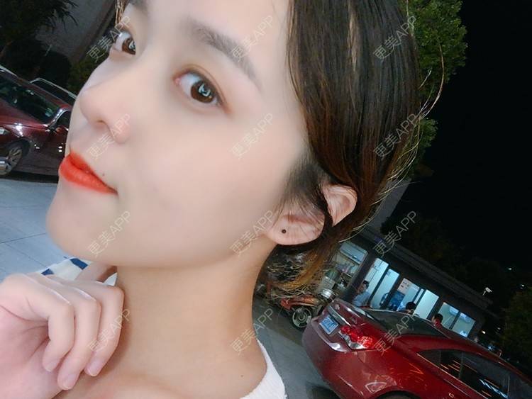 更美 - 更美用户m4XQ4UtYyh的菲欧曼经验 | 杭州 | 菲欧曼