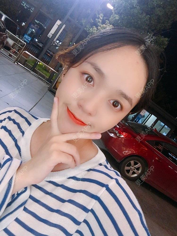 更美 - 更美用户m4XQ4UtYyh的菲欧曼经验 | 杭州 | 菲欧曼