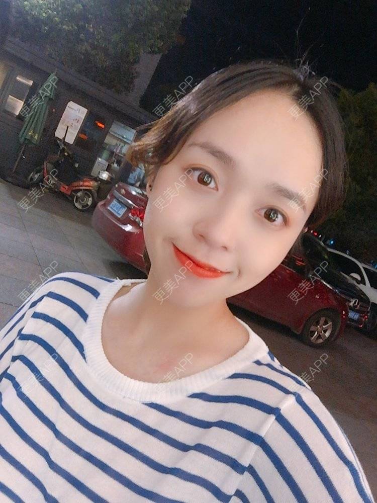 更美 - 更美用户m4XQ4UtYyh的菲欧曼经验 | 杭州 | 菲欧曼